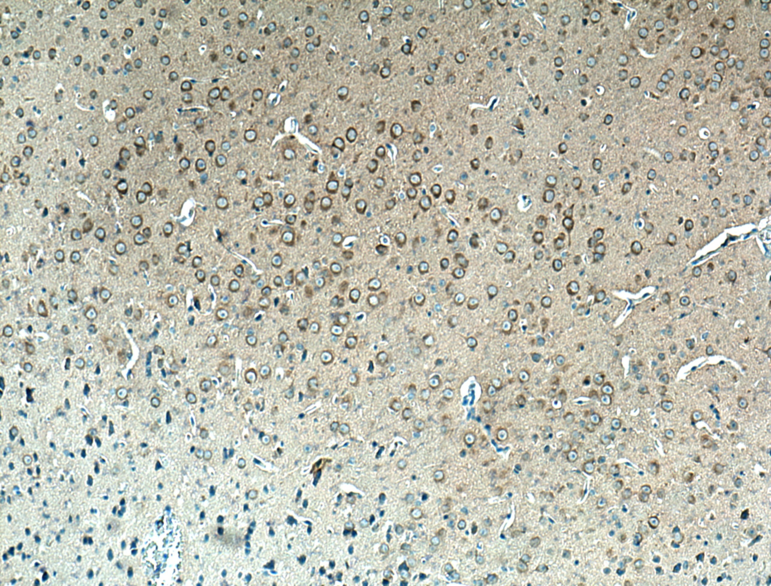 Immunohistochemistry (IHC) staining of mouse brain tissue using REEP2 Polyclonal antibody (15684-1-AP)