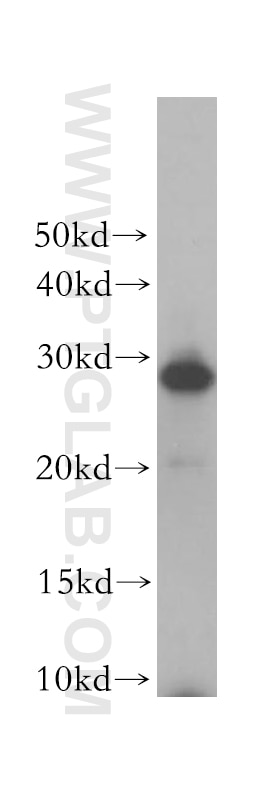 Western Blot (WB) analysis of human skeletal muscle tissue using REEP2 Polyclonal antibody (15684-1-AP)