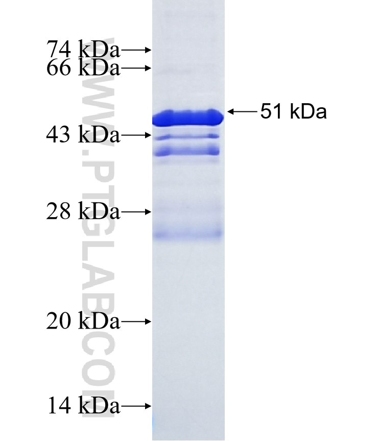 REEP3 fusion protein Ag18312 SDS-PAGE