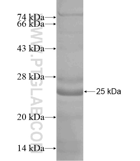 REEP3 fusion protein Ag19400 SDS-PAGE