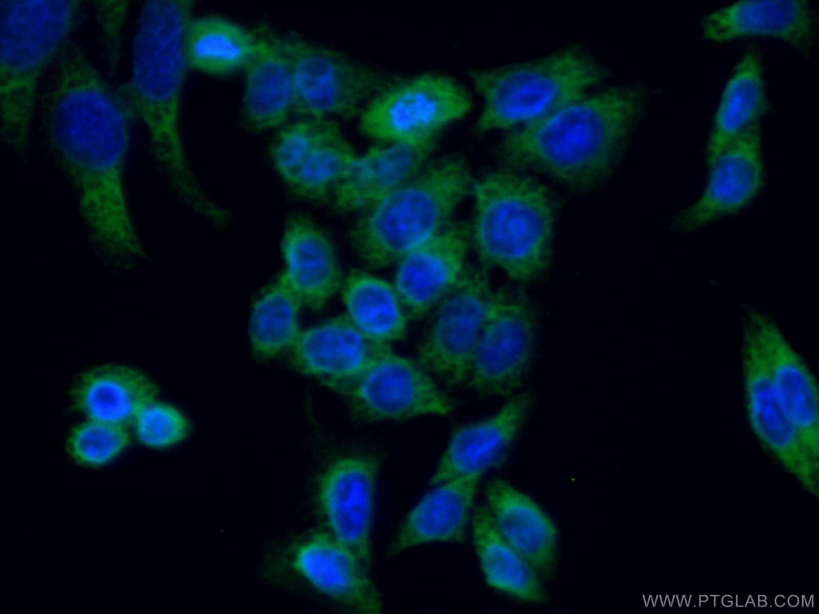 Immunofluorescence (IF) / fluorescent staining of HeLa cells using REEP4 Polyclonal antibody (26650-1-AP)