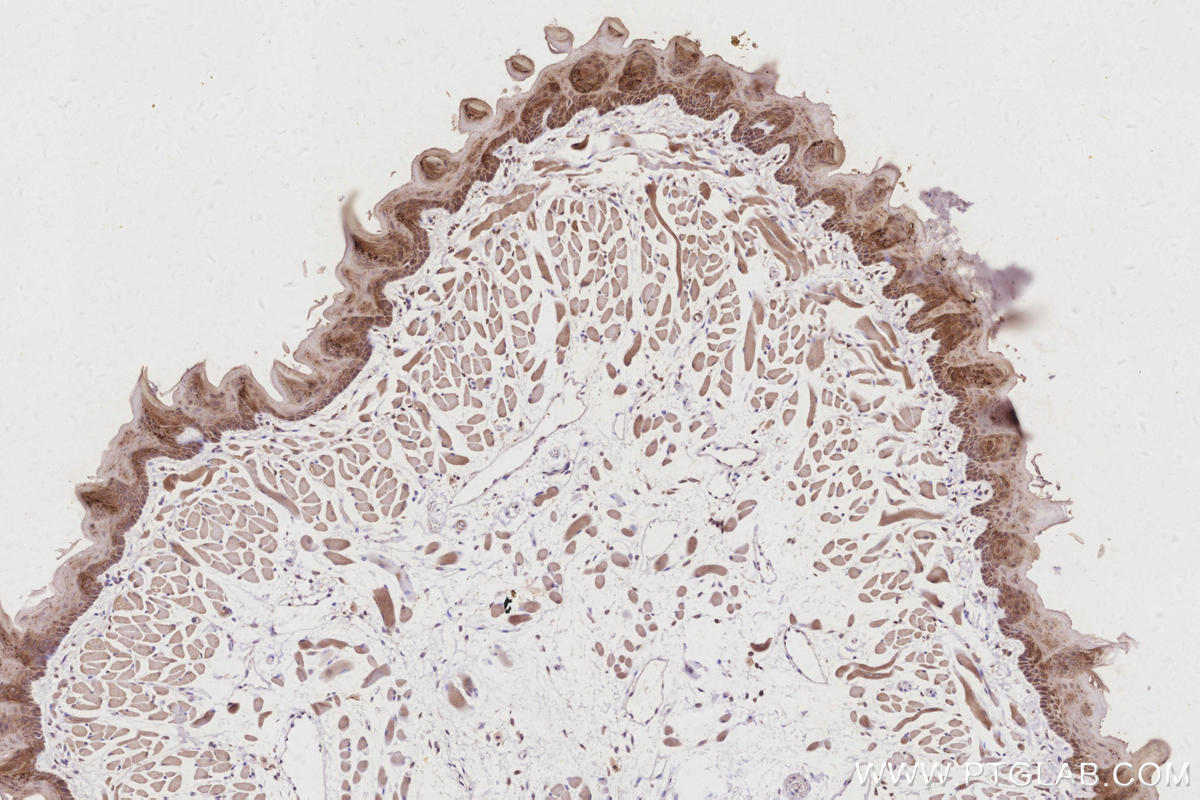 Immunohistochemistry (IHC) staining of mouse tongue tissue using REEP4 Polyclonal antibody (26650-1-AP)