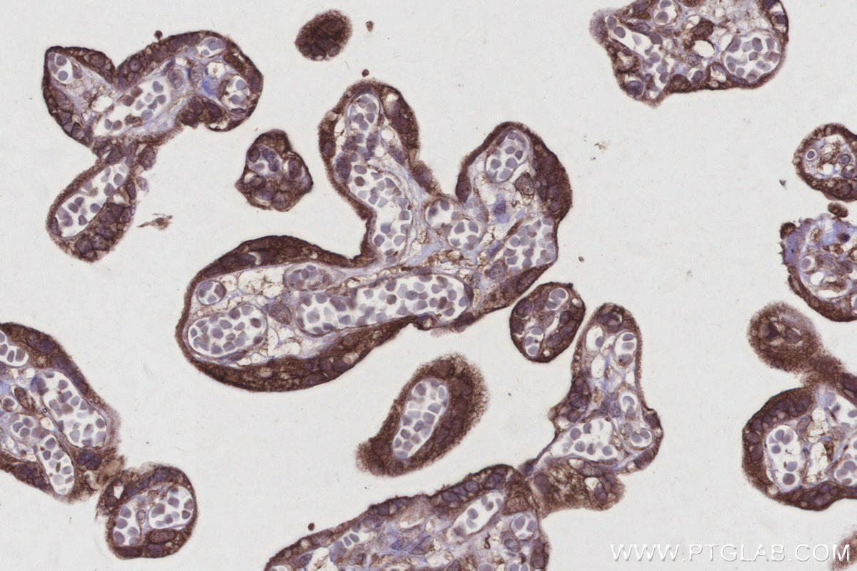 Immunohistochemistry (IHC) staining of human placenta tissue using REEP4 Polyclonal antibody (26650-1-AP)