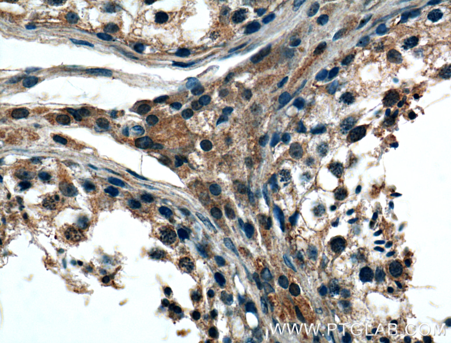Immunohistochemistry (IHC) staining of human testis tissue using REEP4 Polyclonal antibody (26650-1-AP)