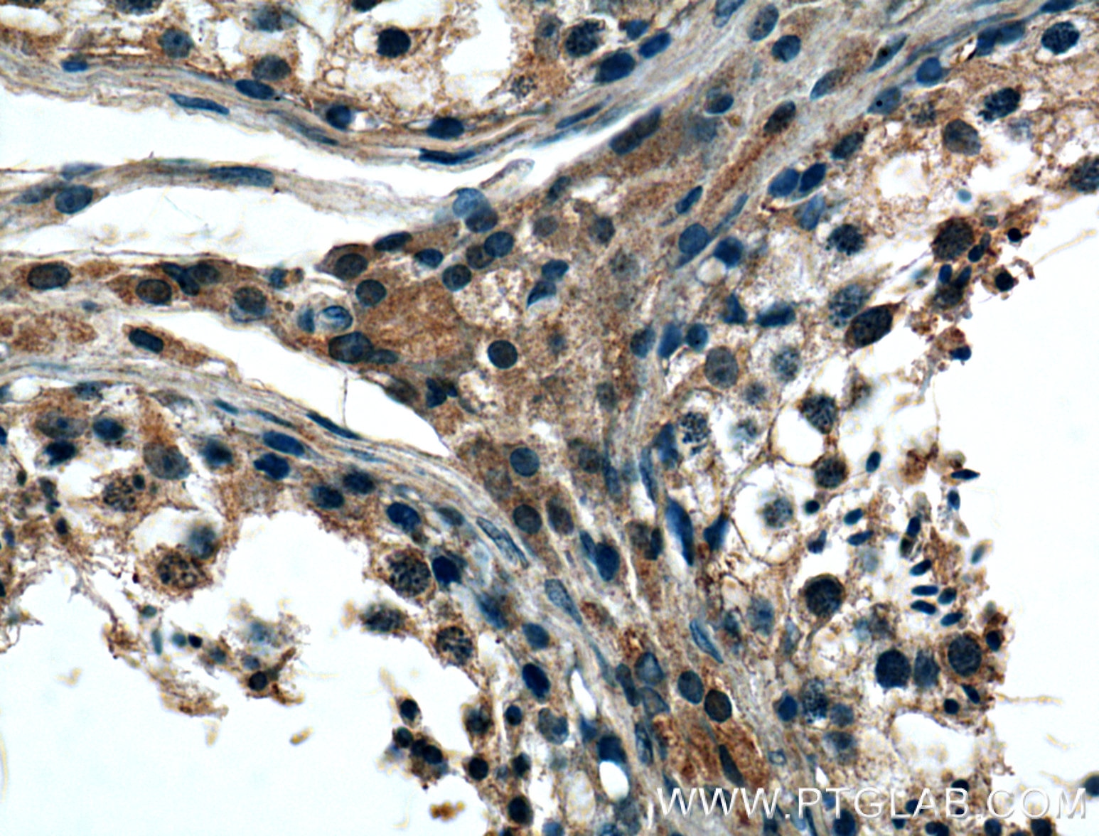 IHC staining of human testis using 26650-1-AP