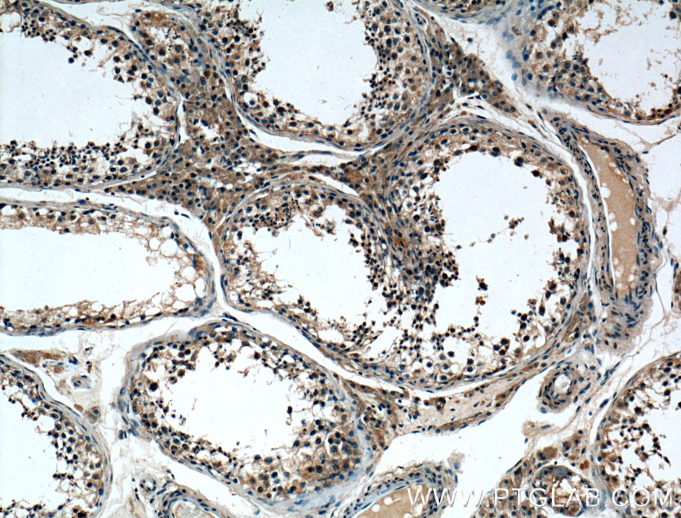 Immunohistochemistry (IHC) staining of human testis tissue using REEP4 Polyclonal antibody (26650-1-AP)