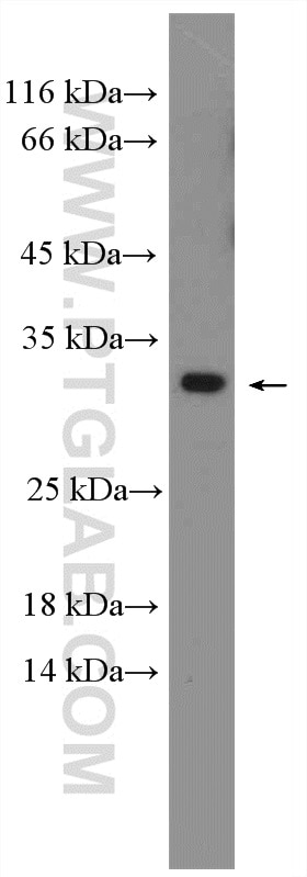 WB analysis of mouse testis using 26650-1-AP