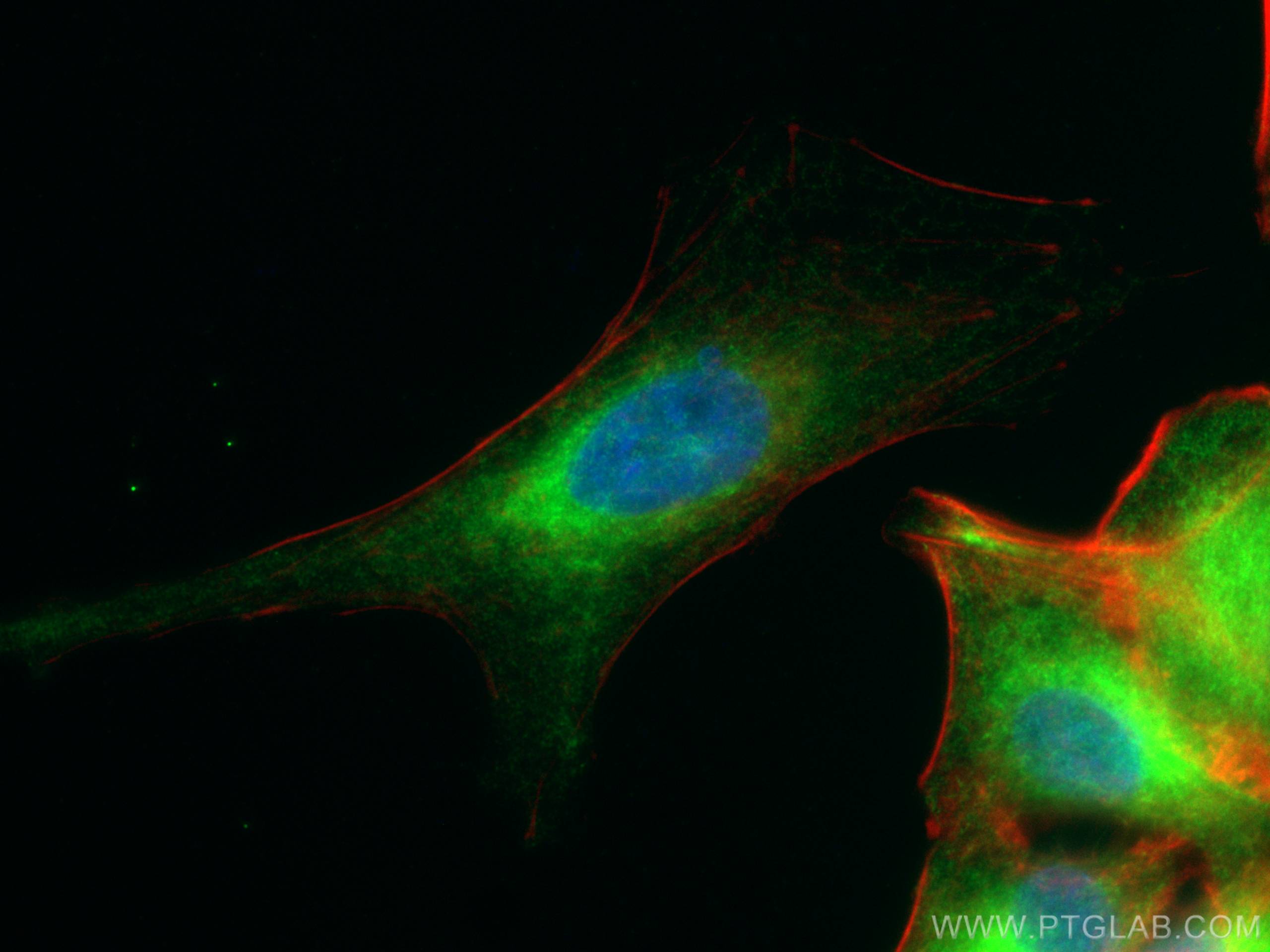 Immunofluorescence (IF) / fluorescent staining of A549 cells using REEP5 Polyclonal antibody (14643-1-AP)