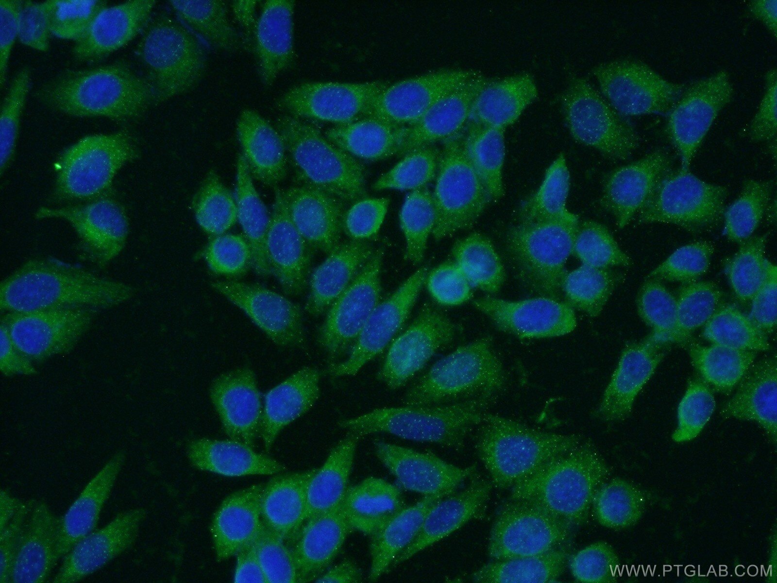 IF Staining of HeLa using 14643-1-AP