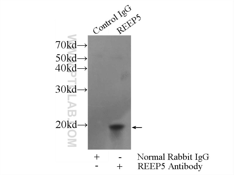 Immunoprecipitation (IP) experiment of HeLa cells using REEP5 Polyclonal antibody (14643-1-AP)