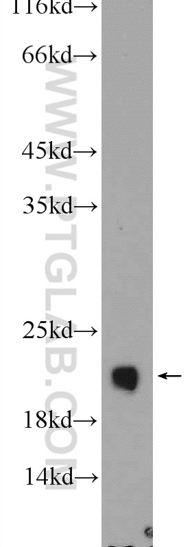 Western Blot (WB) analysis of rat brain tissue using REEP5 Polyclonal antibody (14643-1-AP)
