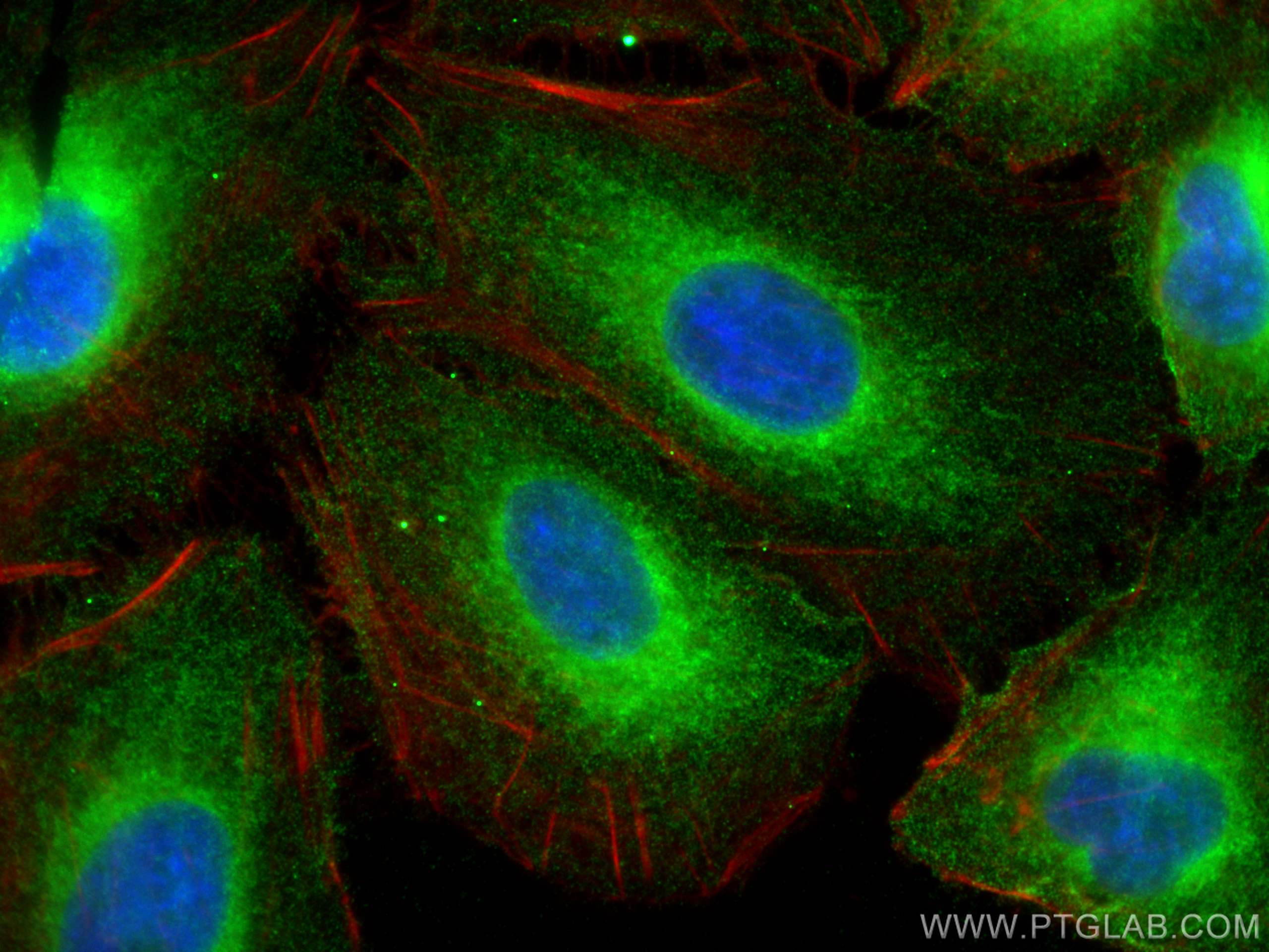 Immunofluorescence (IF) / fluorescent staining of A549 cells using REEP5 Monoclonal antibody (68119-1-Ig)