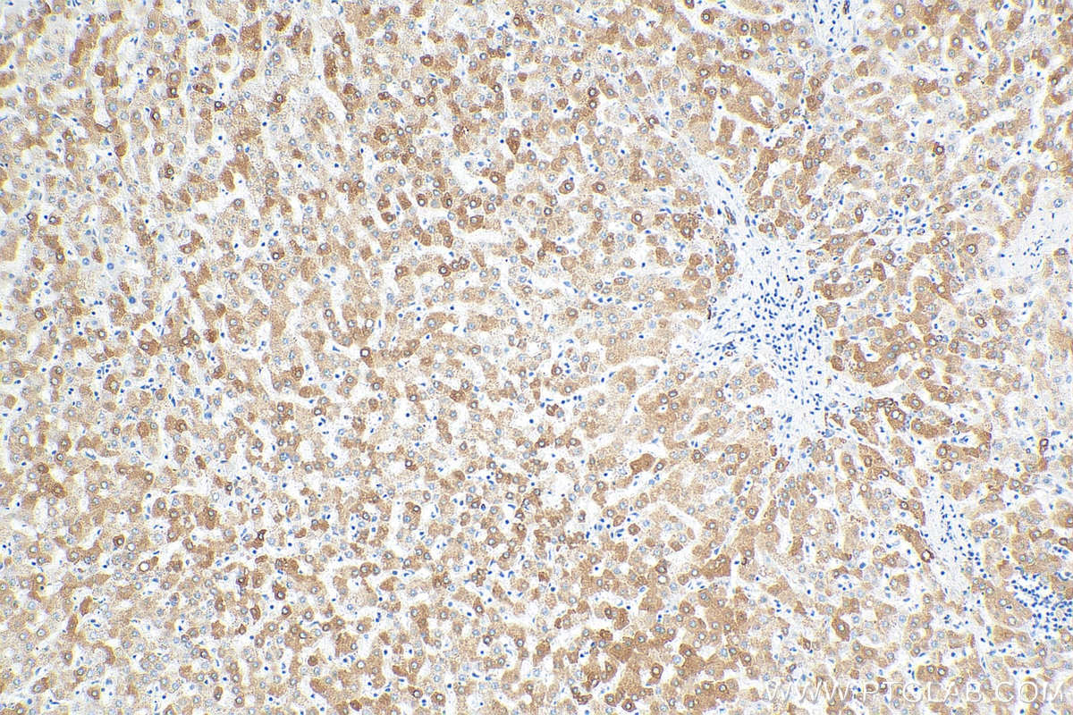 Immunohistochemistry (IHC) staining of human liver tissue using REEP5 Monoclonal antibody (68119-1-Ig)