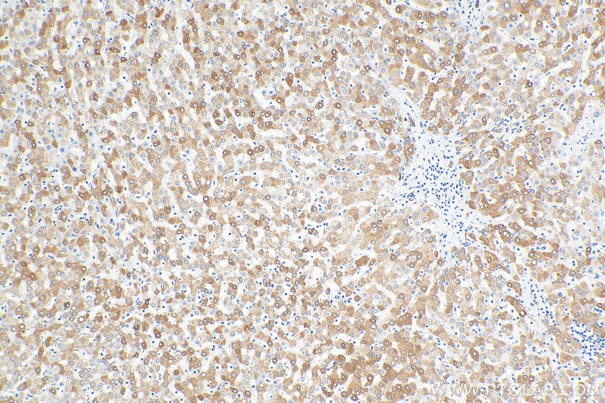 Immunohistochemistry (IHC) staining of human liver tissue using REEP5 Monoclonal antibody (68119-1-Ig)