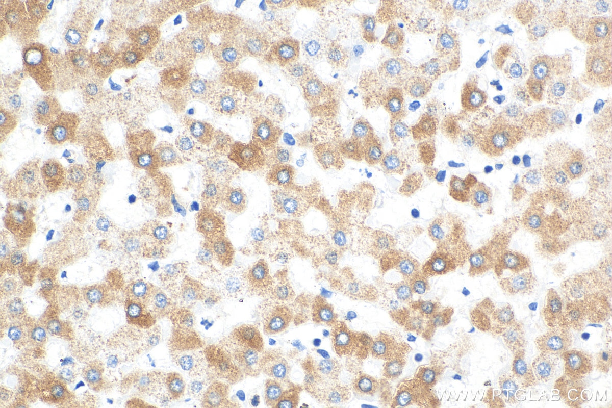 Immunohistochemistry (IHC) staining of human liver tissue using REEP5 Monoclonal antibody (68119-1-Ig)