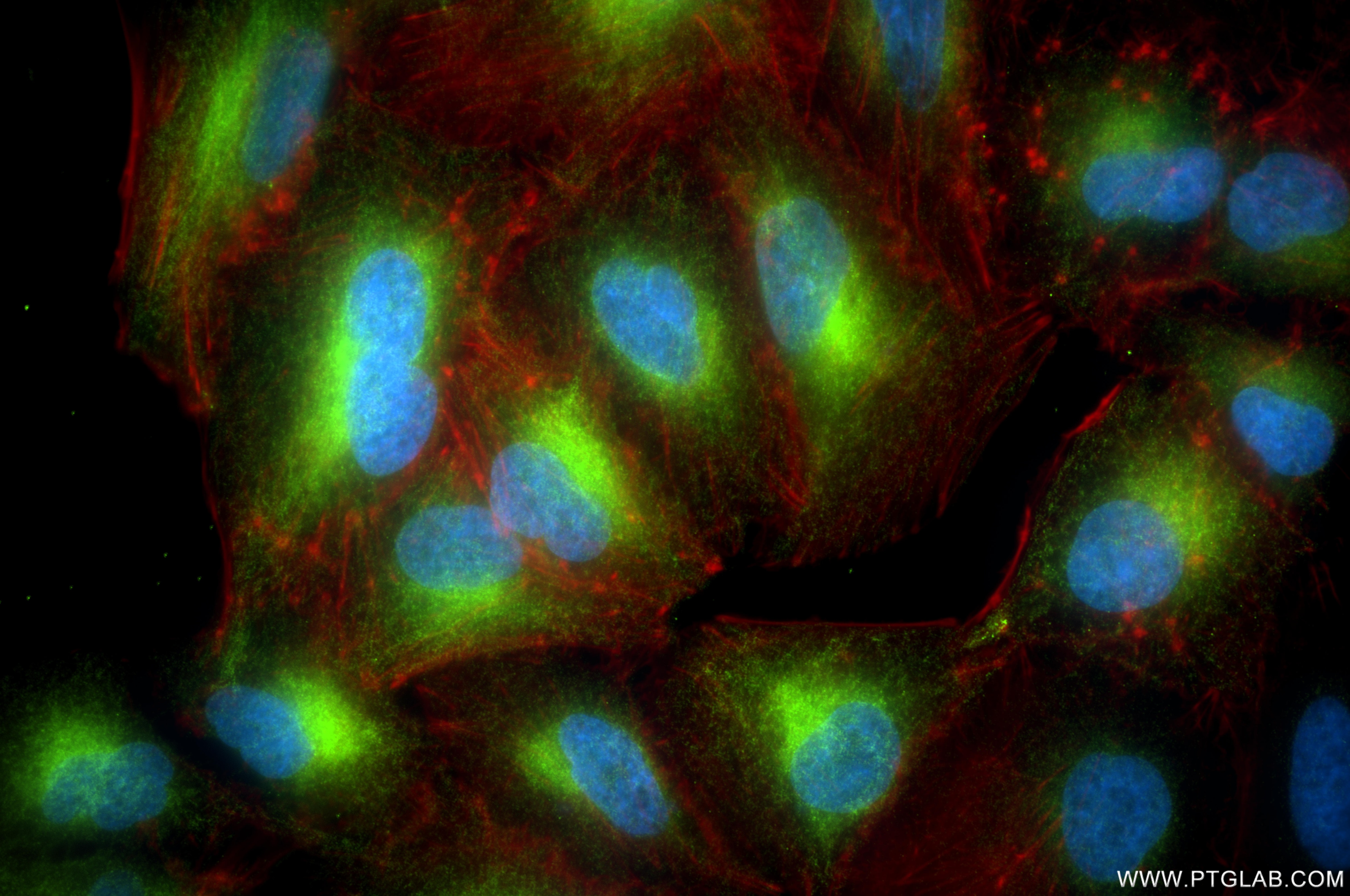 IF Staining of A549 using 86849-1-RR Immunofluorescence (IF) / fluorescent staining of A549 cells using REEP5 Recombinant monoclonal antibody (86849-1-RR)