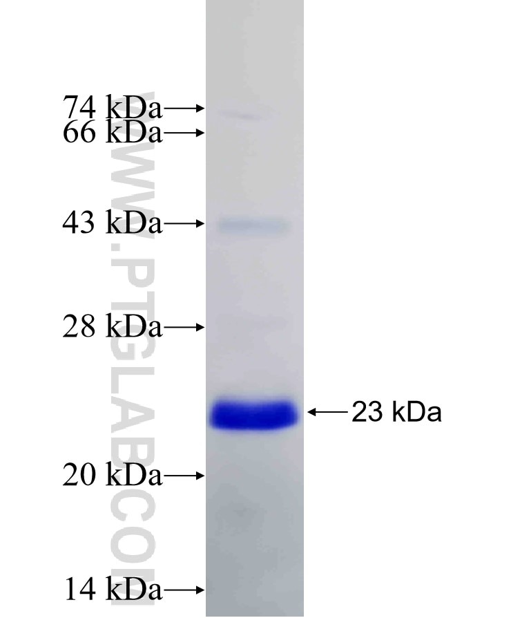 REEP5 fusion protein Ag6229 SDS-PAGE