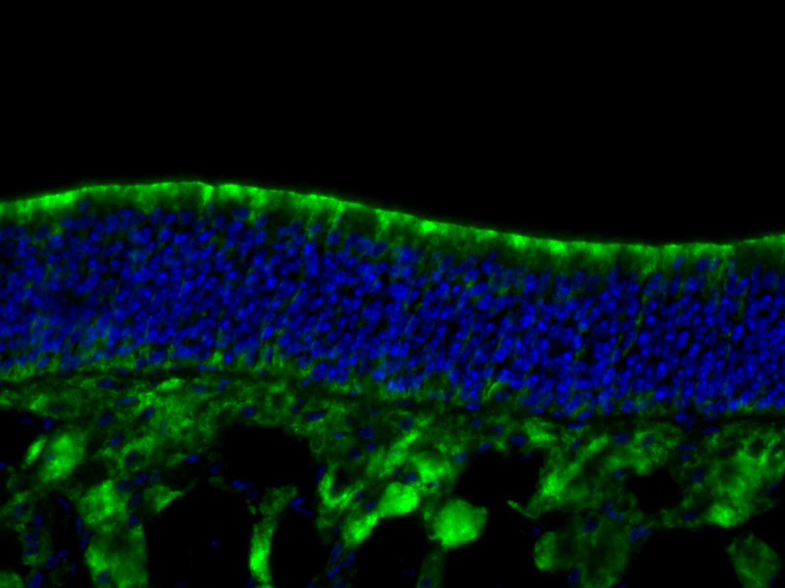 IF Staining of mouse olfactory epithelium tissue using 12088-1-AP