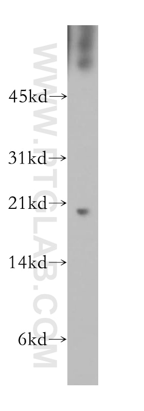 Western Blot (WB) analysis of PC-3 cells using REG1B Polyclonal antibody (13519-1-AP)