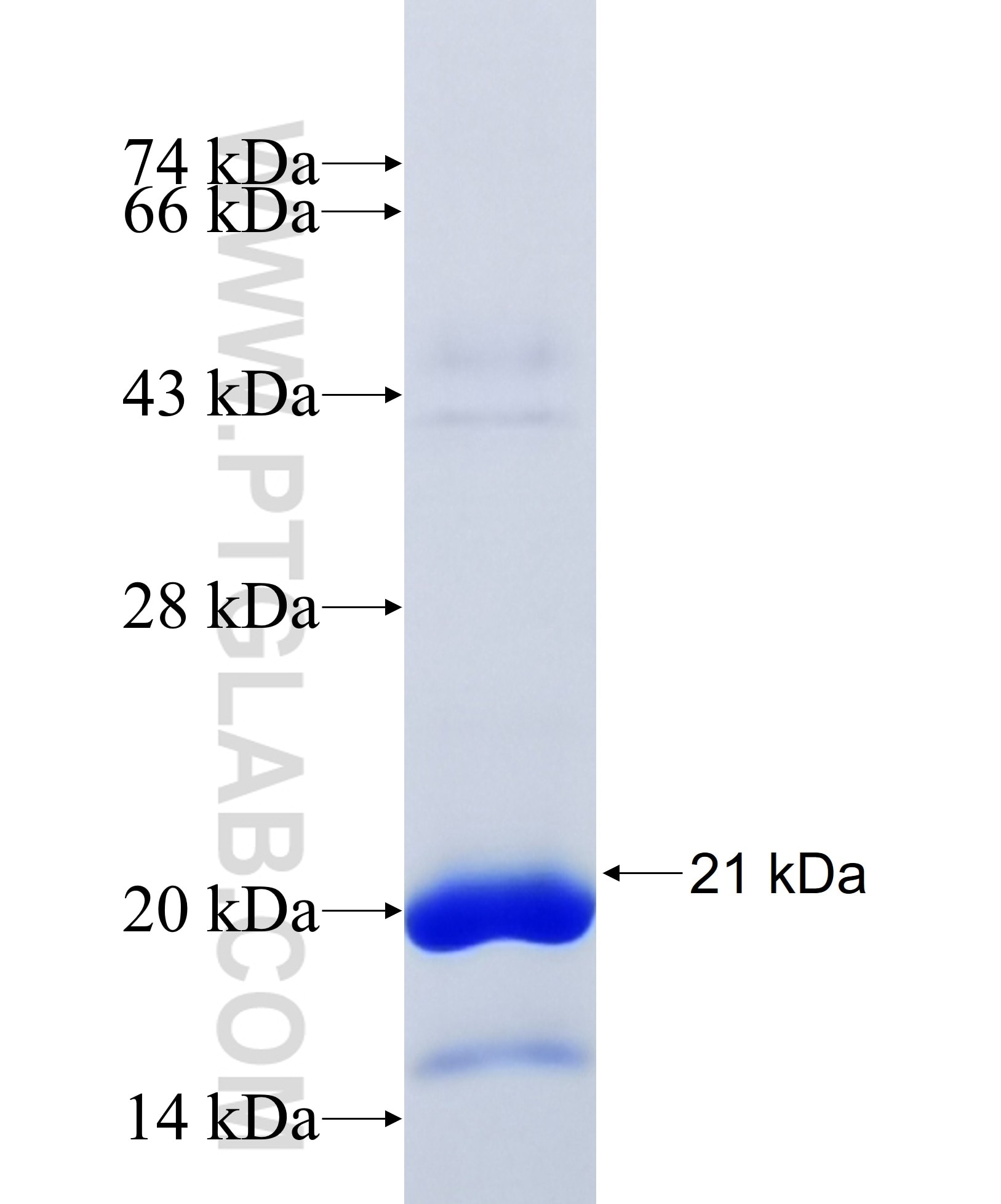 REG1B fusion protein Ag34893 SDS-PAGE REG1B fusion protein Ag34893 SDS-PAGE