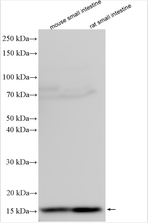 Western Blot (WB) analysis of various lysates using REG3A Polyclonal antibody (13610-1-AP)
