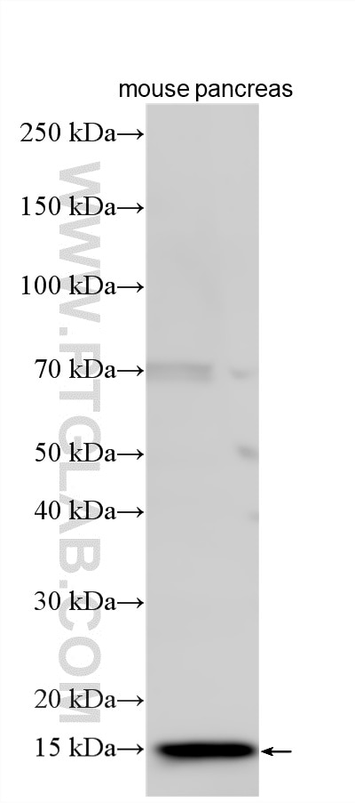 WB analysis using 33895-1-AP Western Blot (WB) analysis of various lysates using REG3G Polyclonal antibody (33895-1-AP)