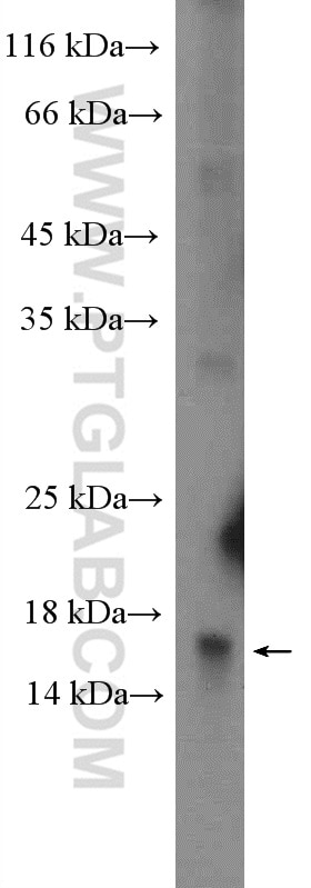 Western Blot (WB) analysis of mouse liver tissue using REG4 Polyclonal antibody (12268-1-AP)