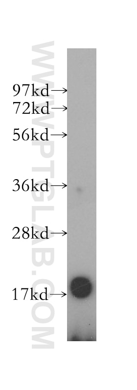 Western Blot (WB) analysis of SGC-7901 cells using REG4 Polyclonal antibody (12268-1-AP)
