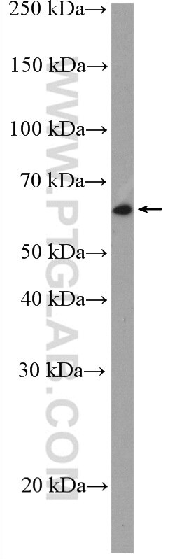 Western Blot (WB) analysis of COLO 320 cells using REL Polyclonal antibody (27693-1-AP)