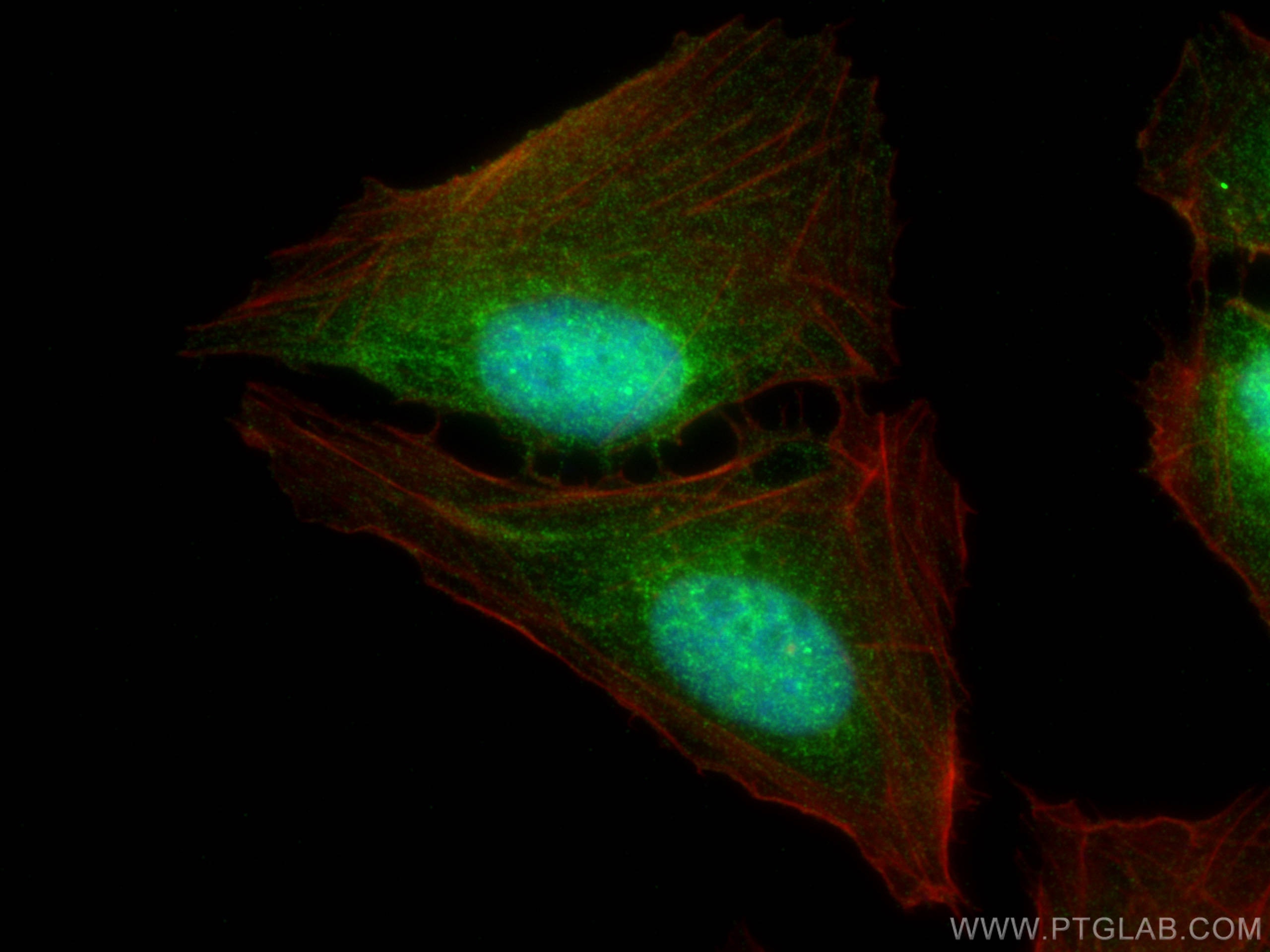 RELB antibody (25027-1-AP) | Proteintech