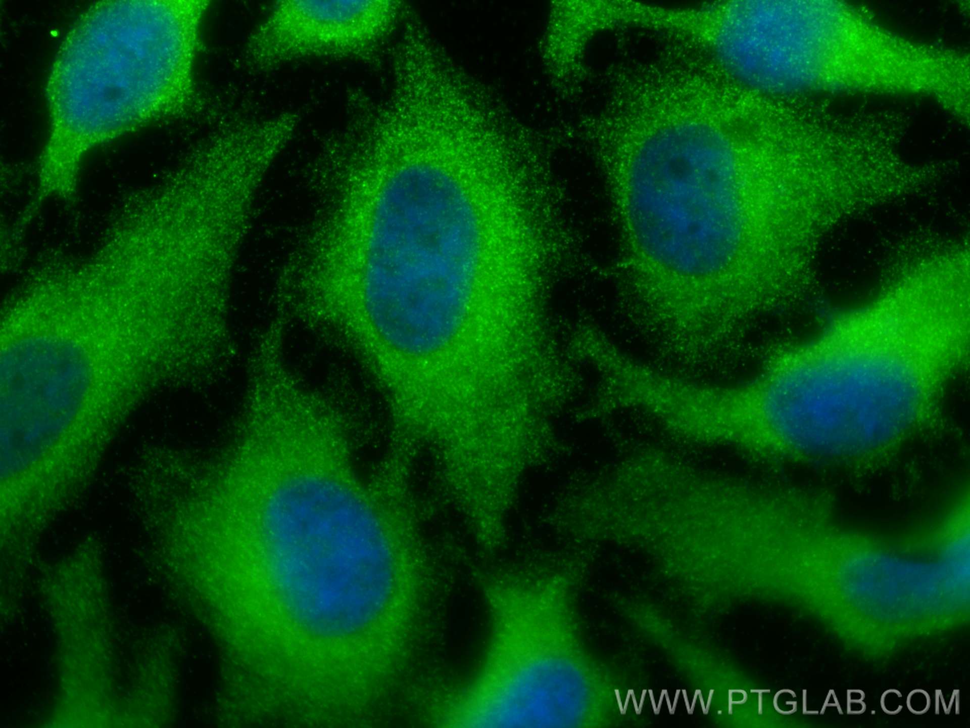 Immunofluorescence (IF) / fluorescent staining of HeLa cells using RELB Polyclonal antibody (25027-1-AP)