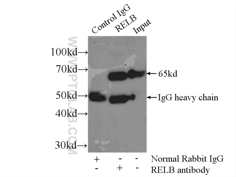 Immunoprecipitation (IP) experiment of Raji cells using RELB Polyclonal antibody (25027-1-AP)