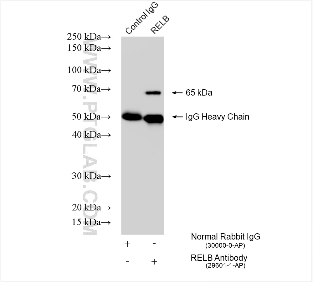Immunoprecipitation (IP) experiment of Raji cells using RELB Polyclonal antibody (29601-1-AP)