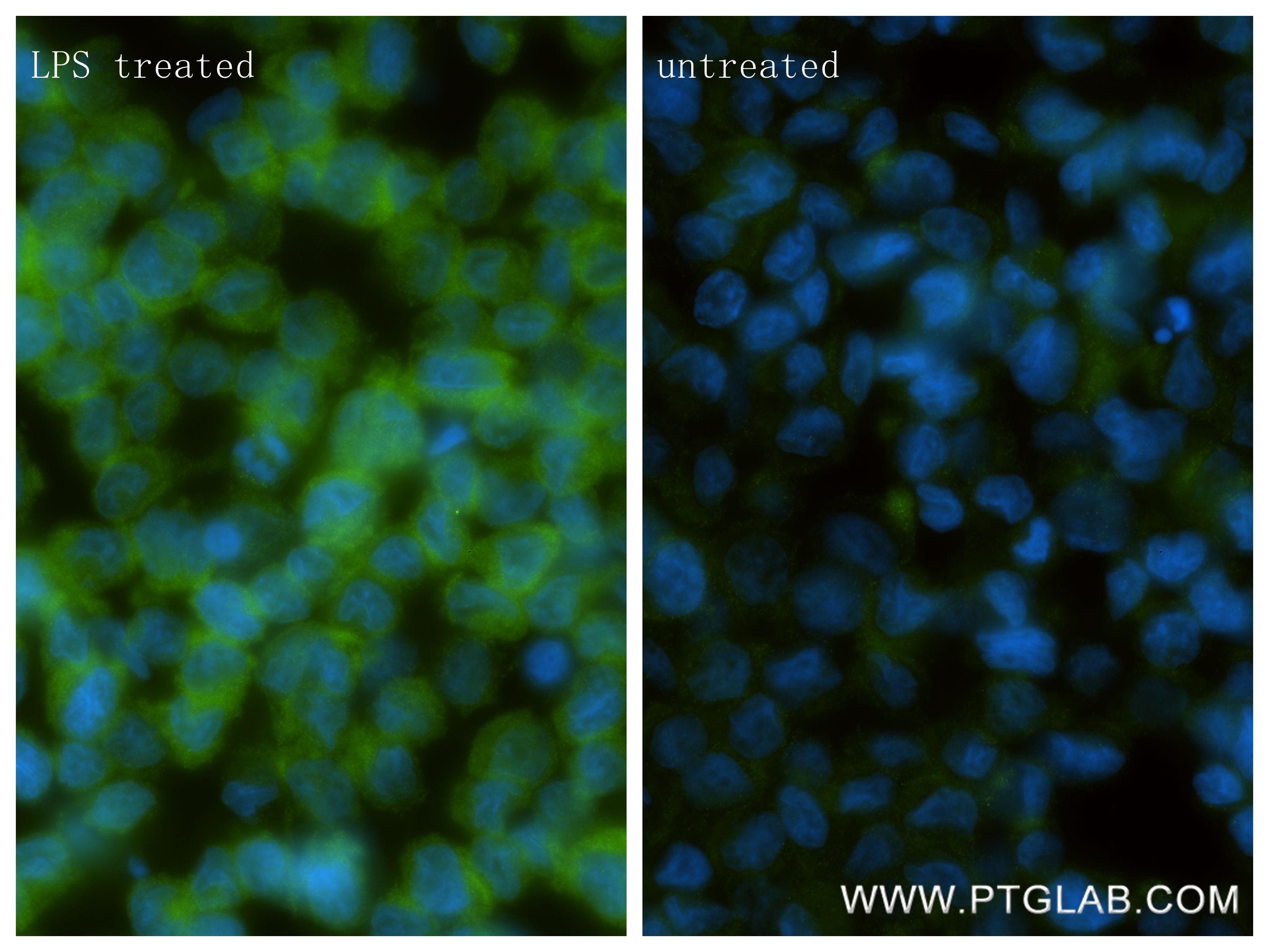 IF Staining of THP-1 using 83305-6-RR Immunofluorescence (IF) / fluorescent staining of THP-1 cells using RELB Recombinant monoclonal antibody (83305-6-RR)