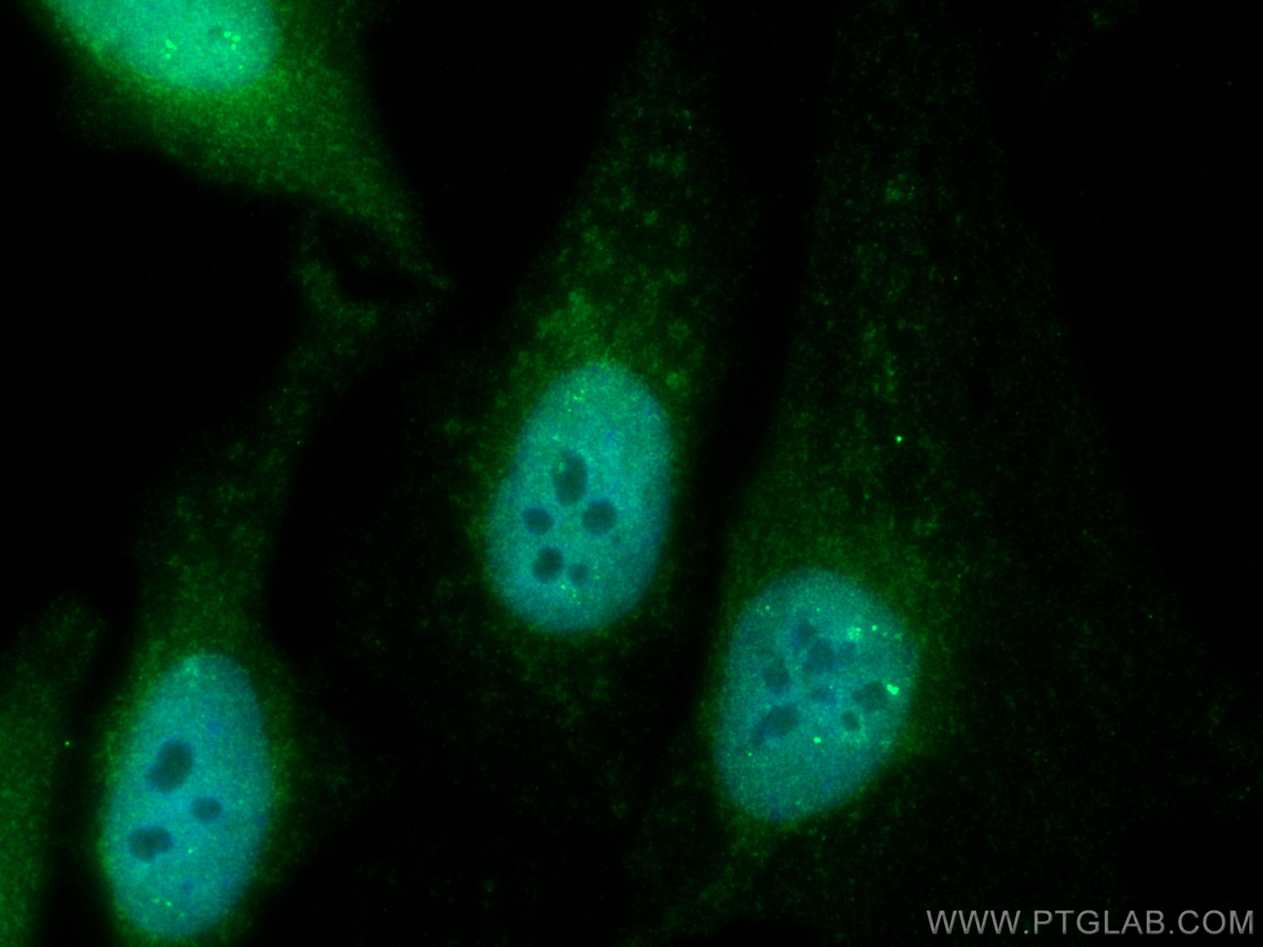 Immunofluorescence (IF) / fluorescent staining of HeLa cells using CoraLite® Plus 488-conjugated RELB Polyclonal anti (CL488-25027)