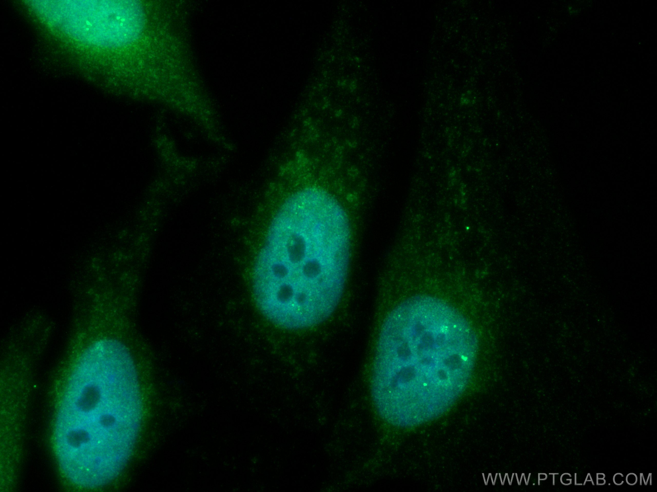 IF Staining of HeLa using CL488-25027