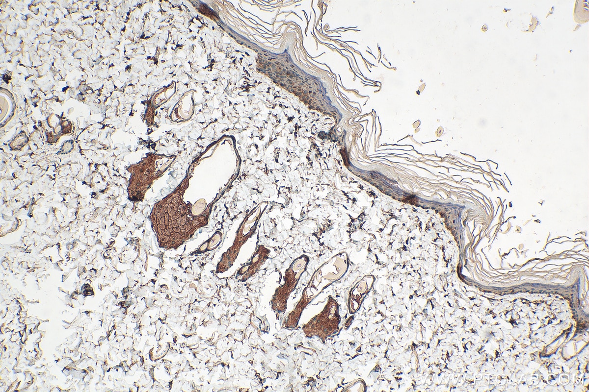 Immunohistochemistry (IHC) staining of rat skin tissue using RELL1 Polyclonal antibody (29823-1-AP)