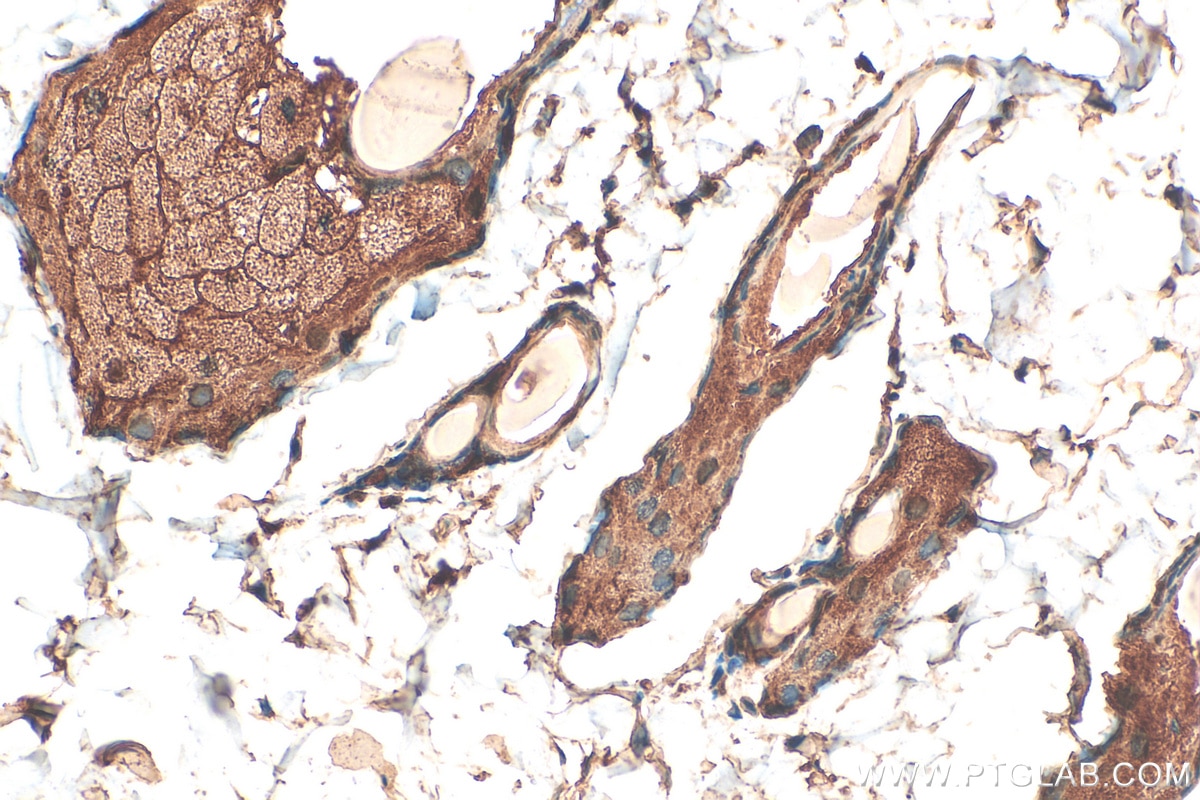 Immunohistochemistry (IHC) staining of rat skin tissue using RELL1 Polyclonal antibody (29823-1-AP)