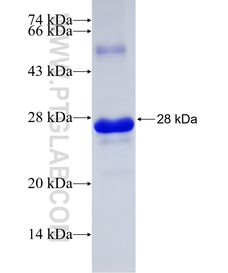 RELL1 fusion protein Ag31489 SDS-PAGE