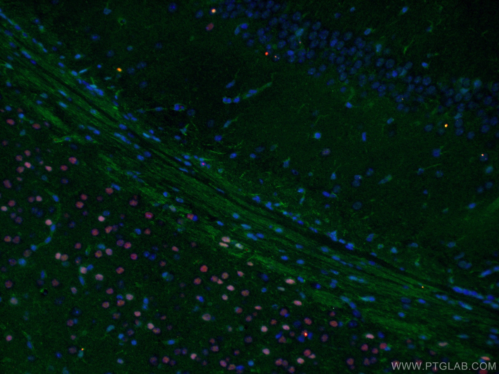 Immunofluorescence (IF) / fluorescent staining of mouse brain tissue using RELN Polyclonal antibody (20689-1-AP)