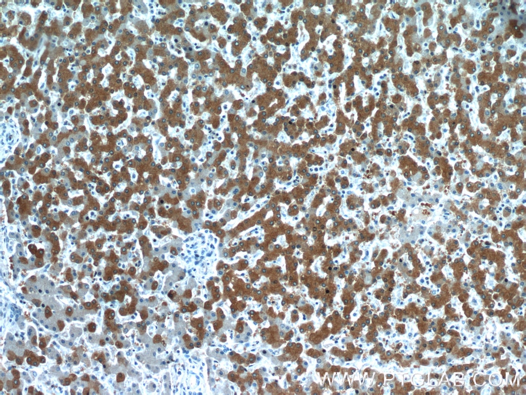 Immunohistochemistry (IHC) staining of human liver tissue using RELN Polyclonal antibody (20689-1-AP)