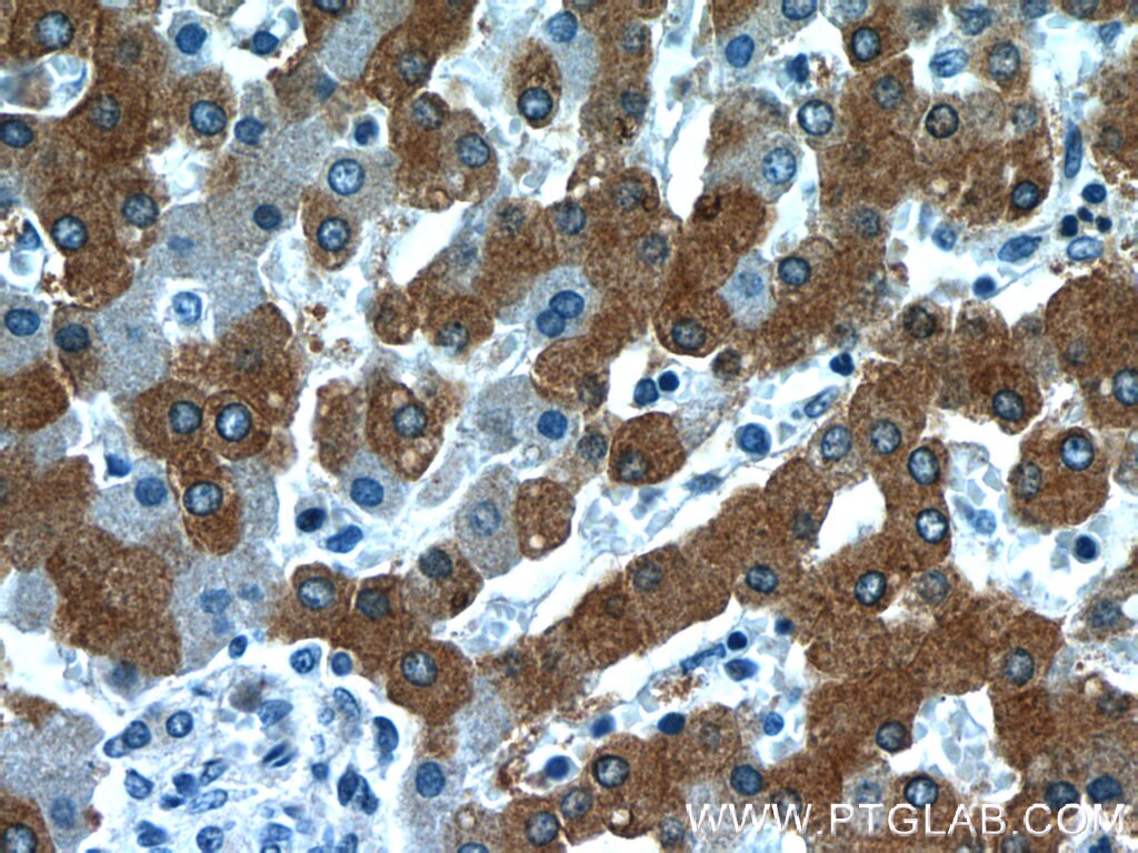 Immunohistochemistry (IHC) staining of human liver tissue using RELN Polyclonal antibody (20689-1-AP)
