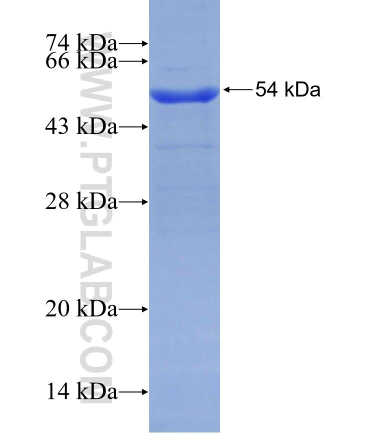RELN fusion protein Ag29430 SDS-PAGE