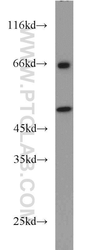 WB analysis of PC-3 using 14532-1-AP