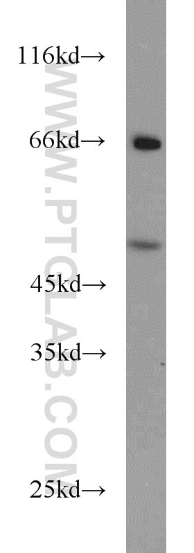 Western Blot (WB) analysis of HeLa cells using RELT Polyclonal antibody (14532-1-AP)