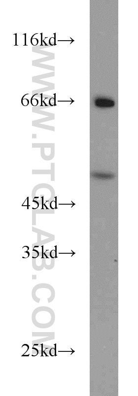 WB analysis of HeLa using 14532-1-AP