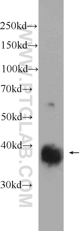 Western Blot (WB) analysis of fetal human brain tissue using REM2 Polyclonal antibody (25371-1-AP)