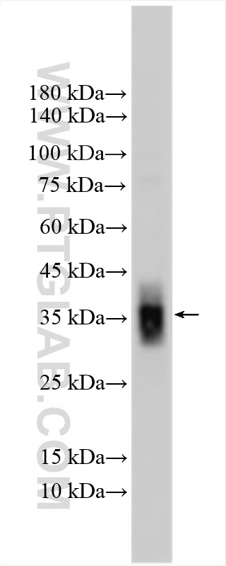 Western Blot (WB) analysis of mouse brain tissue using REM2 Polyclonal antibody (25371-1-AP)