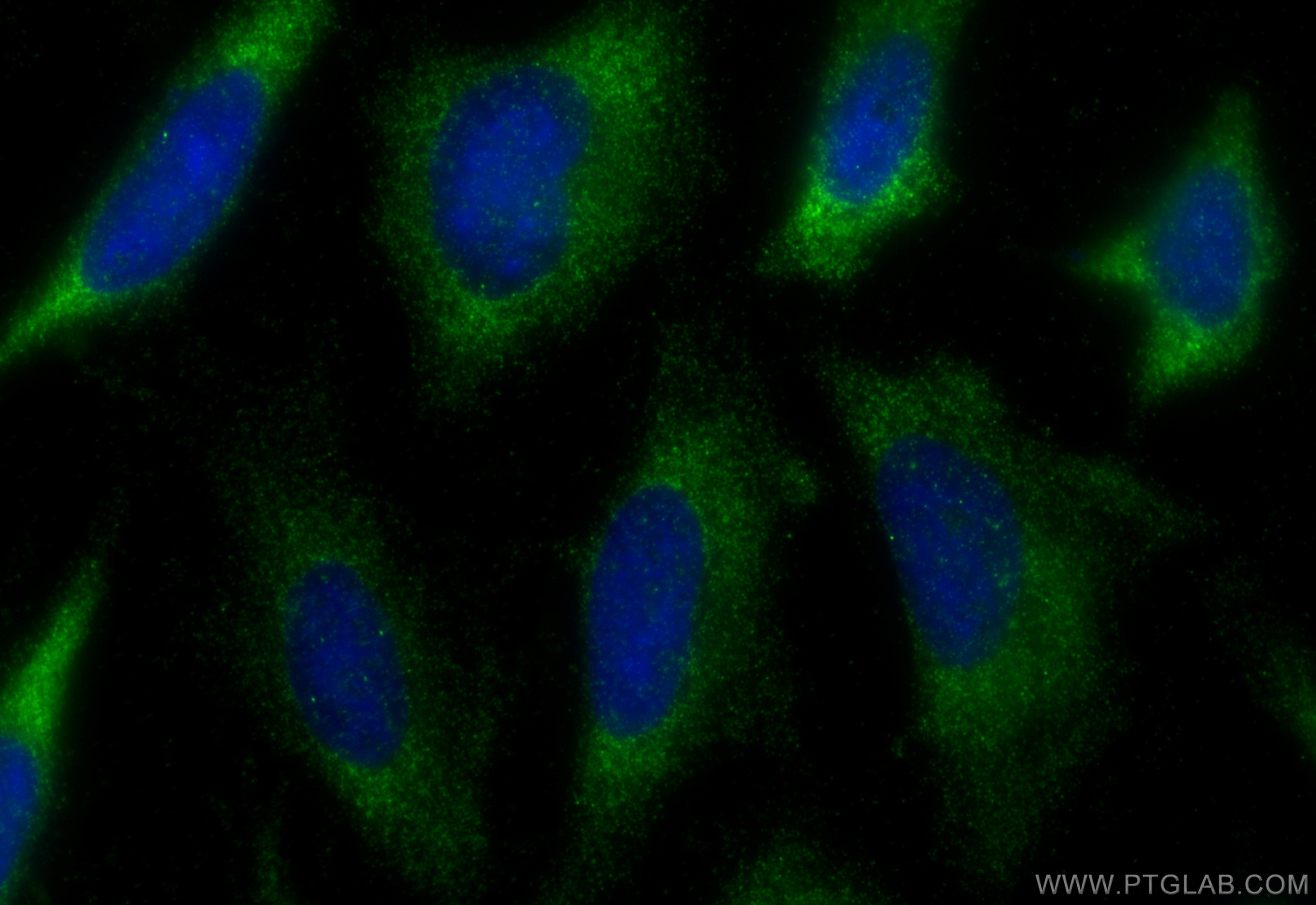 Immunofluorescence (IF) / fluorescent staining of HeLa cells using Renin Polyclonal antibody (14291-1-AP)