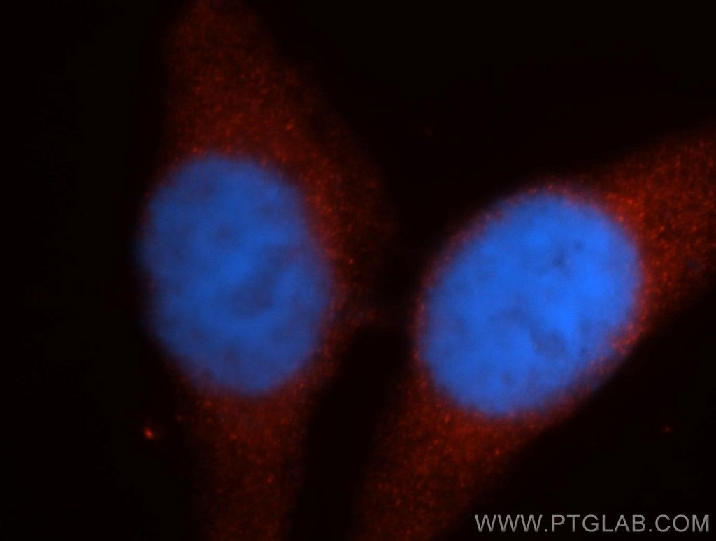 Immunofluorescence (IF) / fluorescent staining of HepG2 cells using Renin Polyclonal antibody (14291-1-AP)